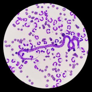 microscopic image of heartworm in dog