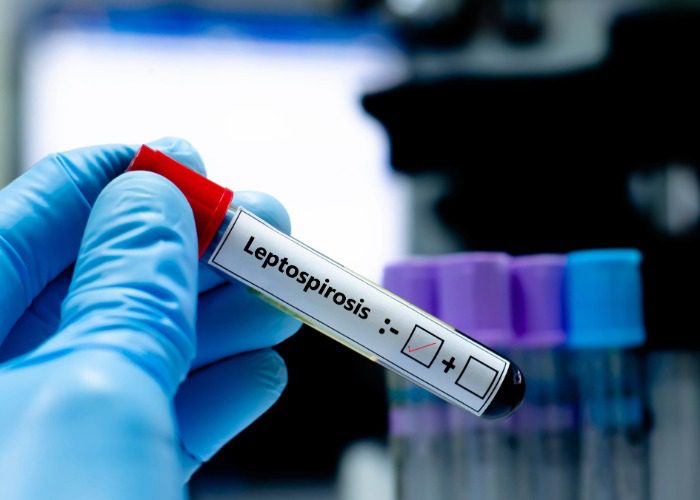 sample blood for Leptospirosis test